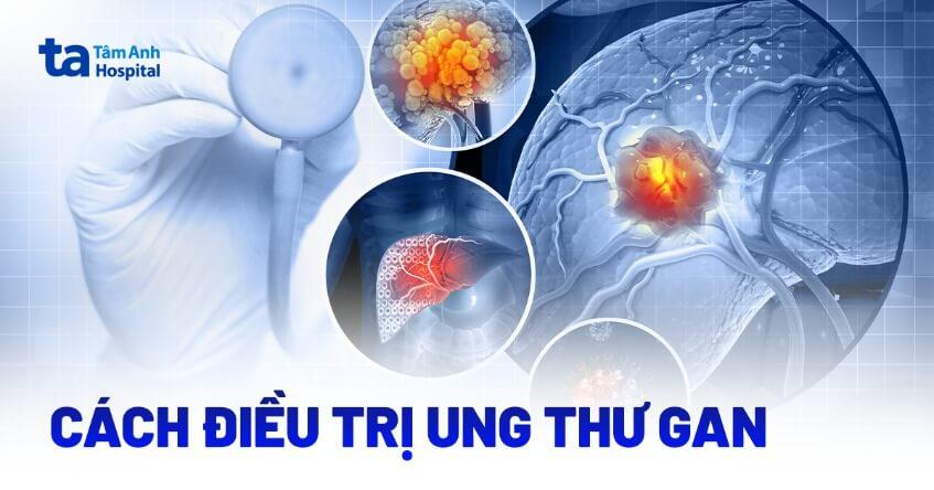 Việt Nam sẽ thử nghiệm lâm sàng thuốc điều trị ung thư mới để tăng cơ hội cho bệnh nhân - Bệnh viện Bãi Cháy