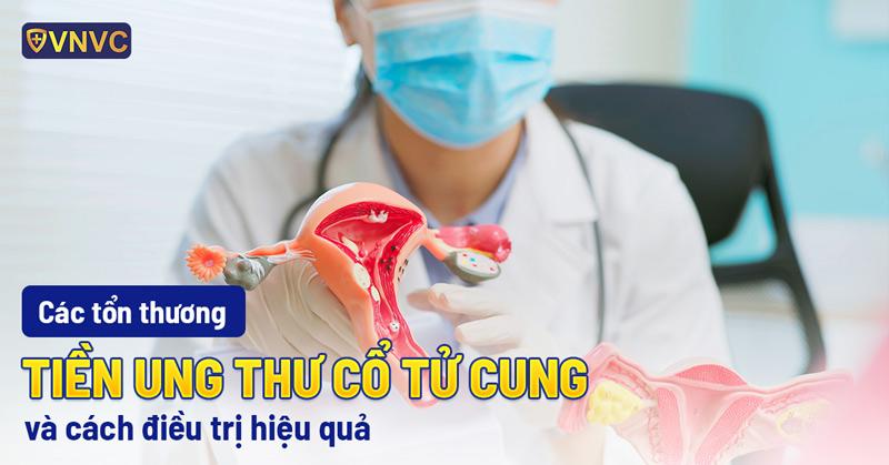 tiền ung thư cổ tử cung