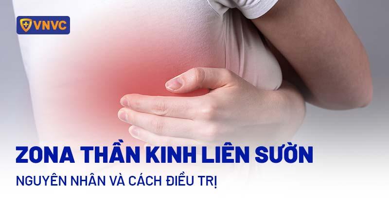 Cách chữa đau thần kinh liên sườn tại nhà hiệu quả, dễ thực hiện 1