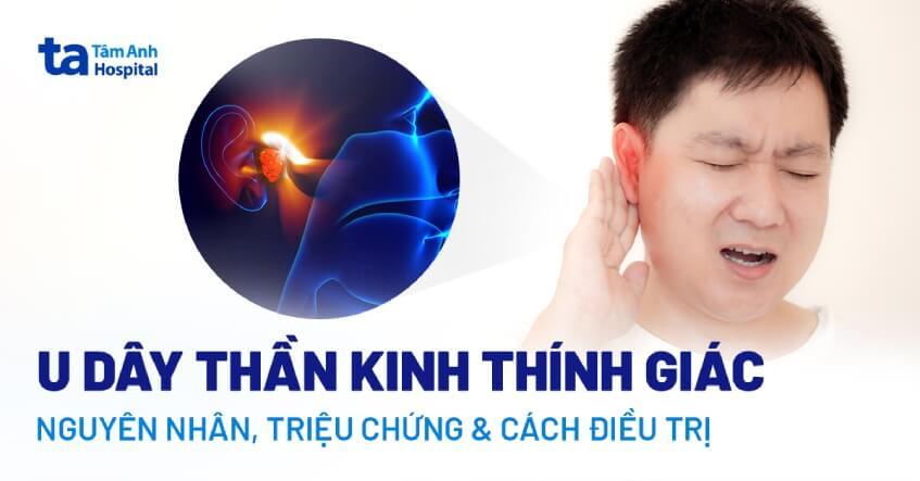 U dây thần kinh số 8: nguyên nhân và cách điều trị